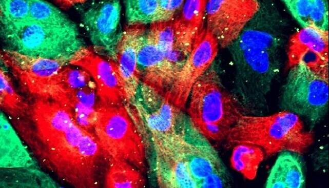 پژوهشی درباره رشد طبیعی یک آنزیم تا شکل‌گیری تومور از آن/ «کینازها» شمشیر دولبه در بدن انسان