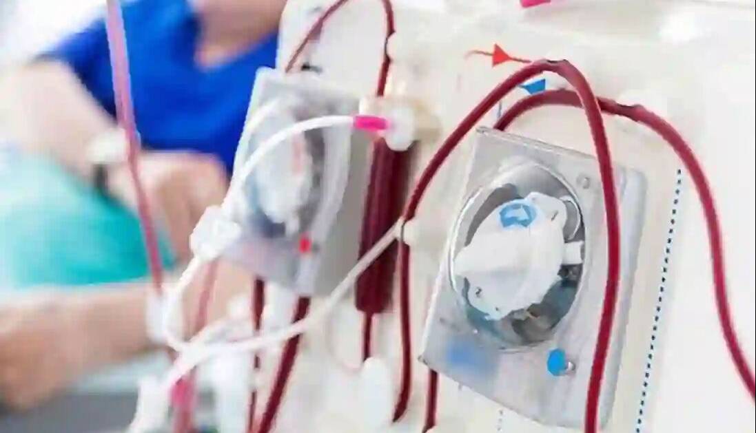 خیرین گیلان پنج دستگاه دیالیز اهدا کردند