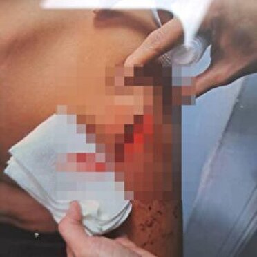 مجروح شدن یک دانش آموز خمامی با چاقوی همکلاسی